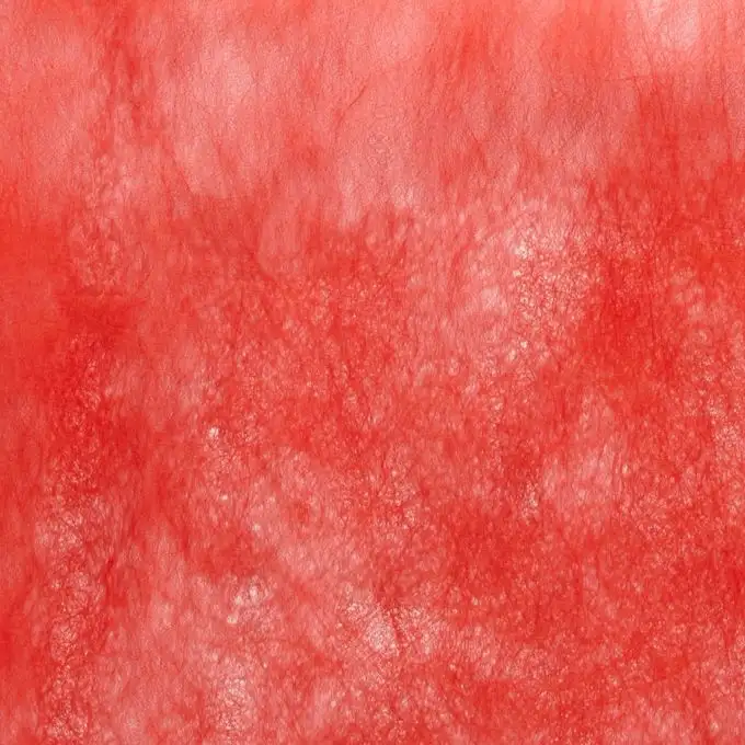 Tessuto non tessuto rosso